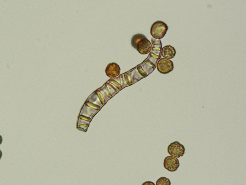 Battarrea-phalloides-11-Spore-Elateri-KOH-1000x.jpg