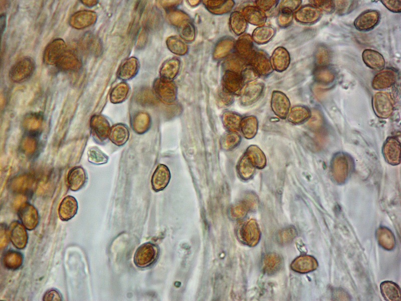 Cortinarius-magicus-(Phlegmacium)-B-13-4-Spore-KOH-1000x.jpg