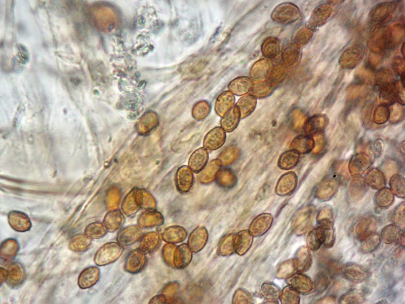 Cortinarius-magicus-(Phlegmacium)-B-15-6-Spore-KOH-1000x.jpg