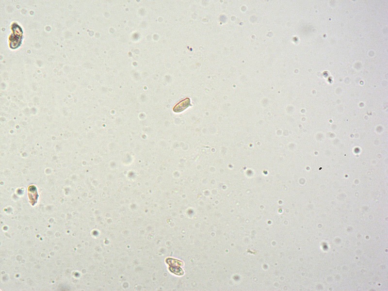 Lepiota-griseovirens-pseudofelina-grangei-14-Spore-RC-600x.jpg