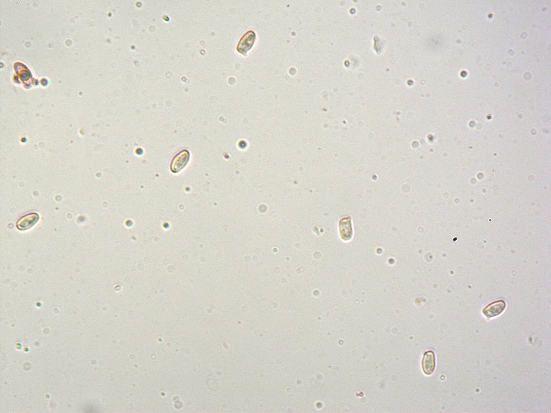 Lepiota-griseovirens-pseudofelina-grangei-17-Spore-RC-600x.jpg
