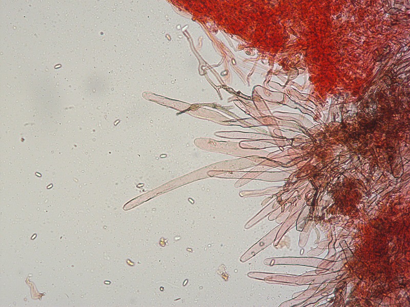 Lepiota-griseovirens-pseudofelina-grangei-19-Pileipellis-RC-200x.jpg