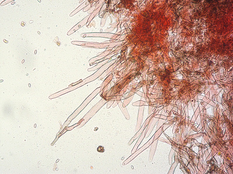 Lepiota-griseovirens-pseudofelina-grangei-21-Pileipellis-RC-200x.jpg